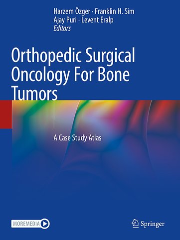 Orthopedic Surgical Oncology For Bone Tumors