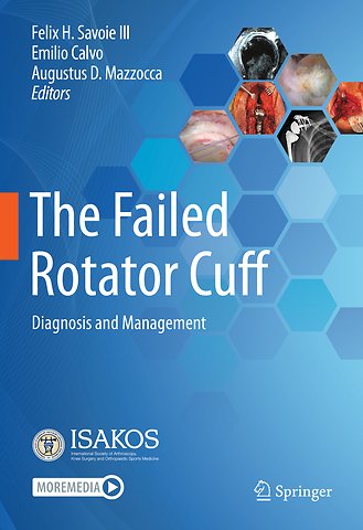 The Failed Rotator Cuff