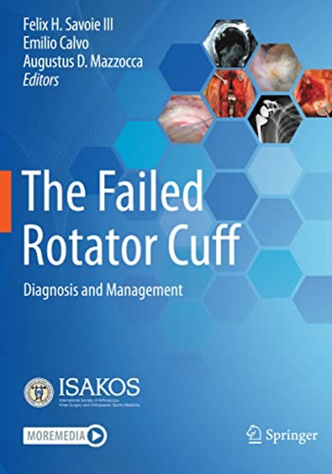 The Failed Rotator Cuff