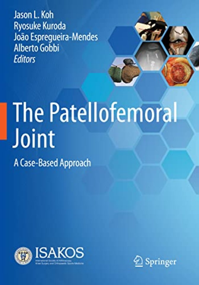 The Patellofemoral Joint