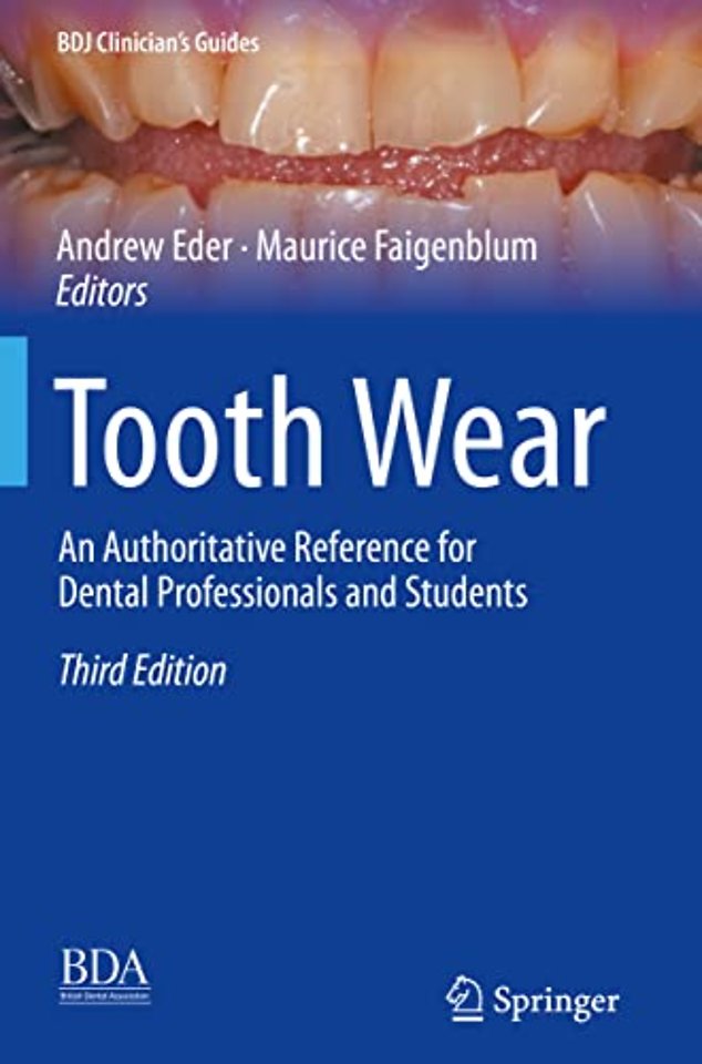 Tooth Wear