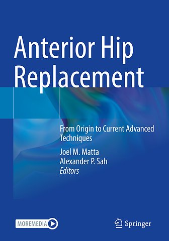 Anterior Hip Replacement