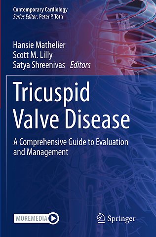 Tricuspid Valve Disease