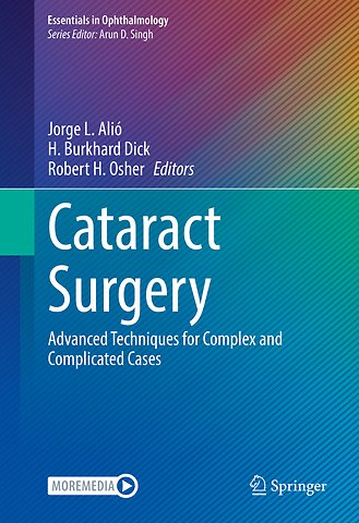 Cataract Surgery