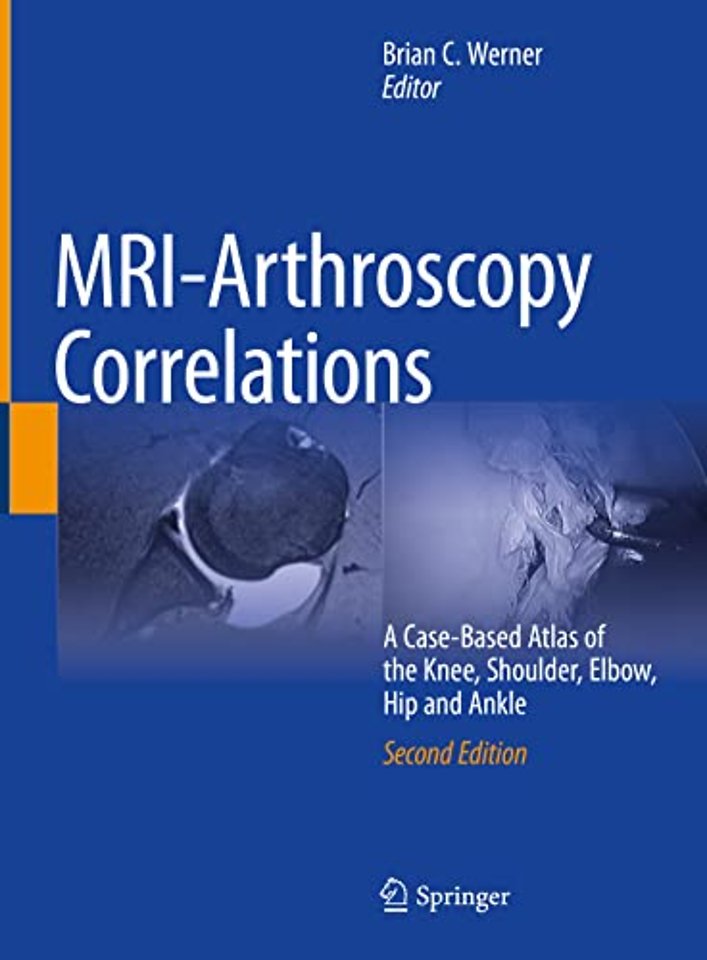 MRI-Arthroscopy Correlations