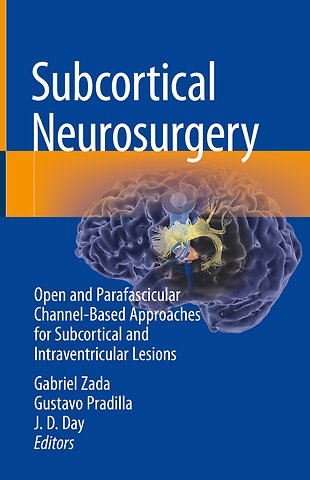 Subcortical Neurosurgery