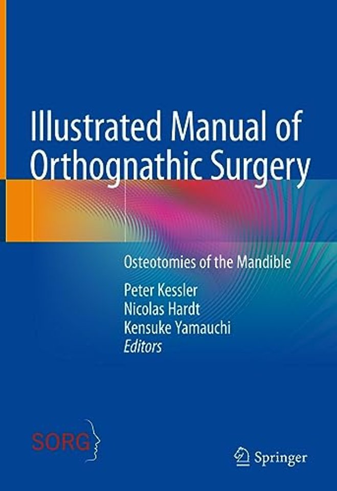 Illustrated Manual of Orthognathic Surgery