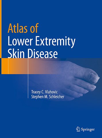 Atlas of Lower Extremity Skin Disease