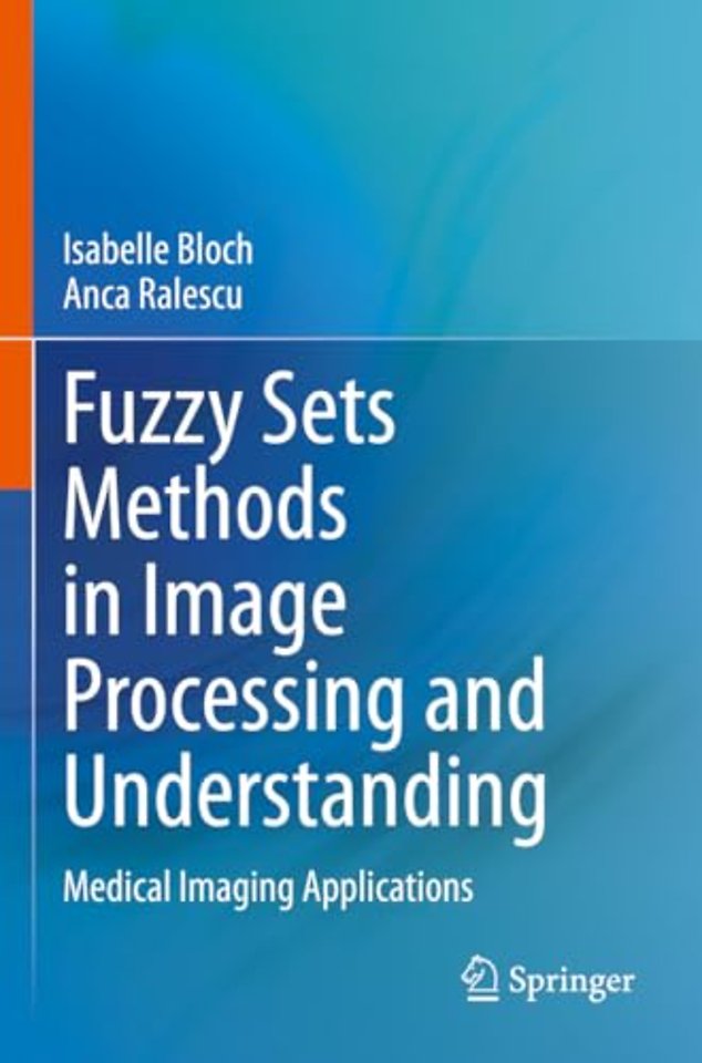 Fuzzy Sets Methods in Image Processing and Understanding