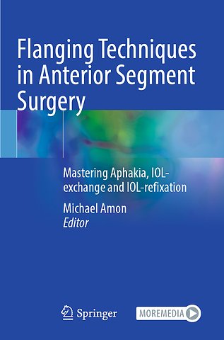 Flanging Techniques in Anterior Segment Surgery