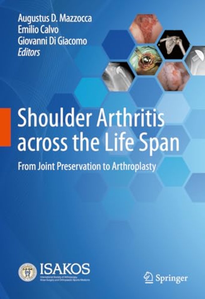 Shoulder Arthritis across the Life Span
