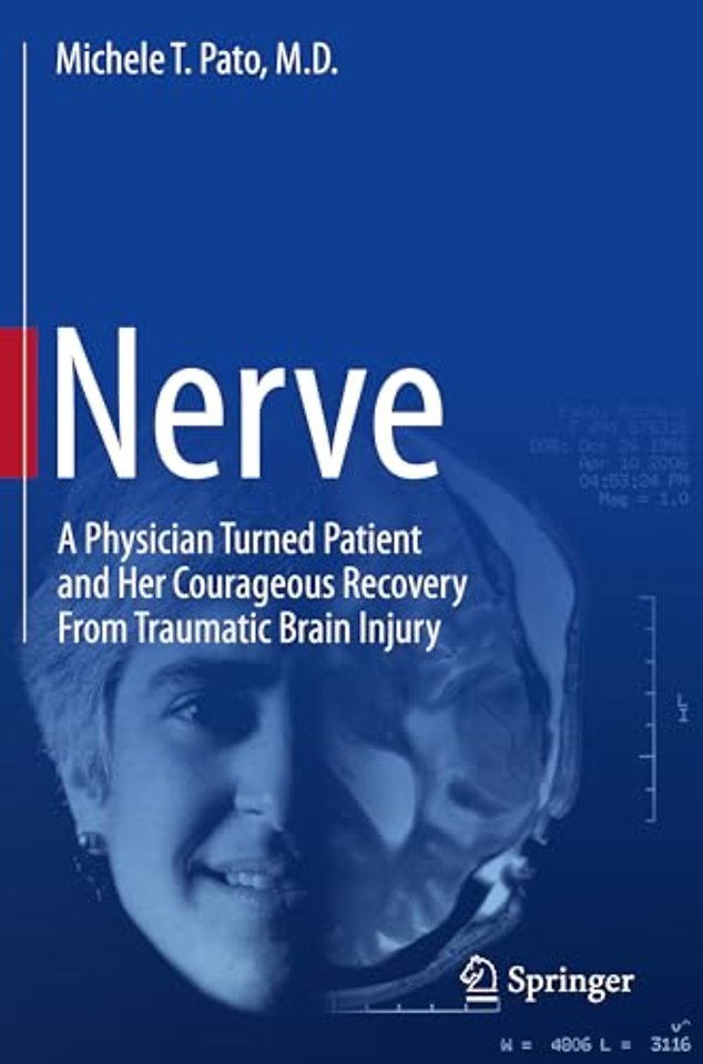 Nerve