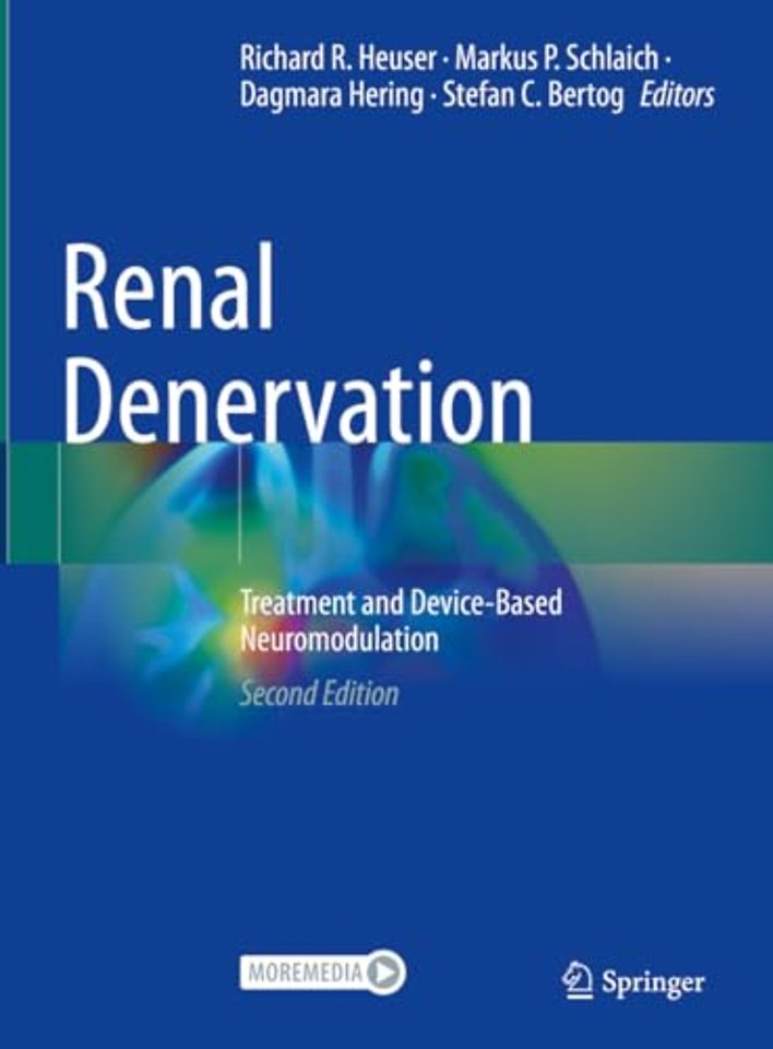 Renal Denervation