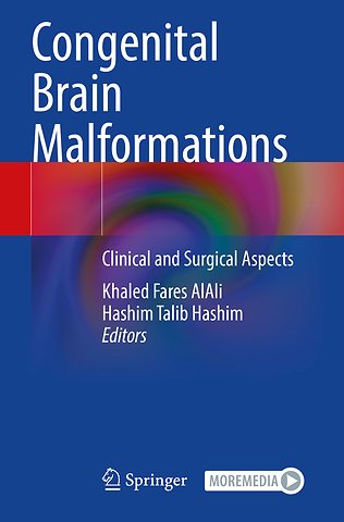 Congenital Brain Malformations