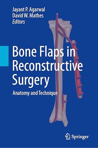 Bone Flaps in Reconstructive Surgery