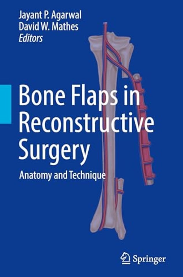 Bone Flaps in Reconstructive Surgery