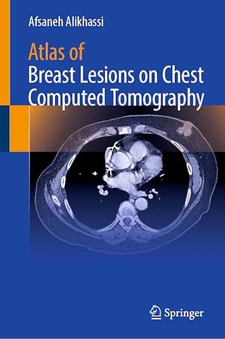 Atlas of Breast Lesions on Chest Computed Tomography