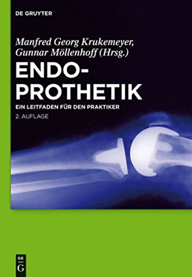 Endoprothetik – Ein Leitfaden für den Praktiker