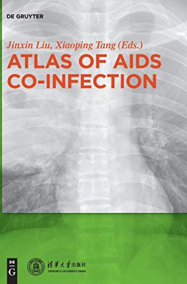 Atlas of AIDS Co-infection