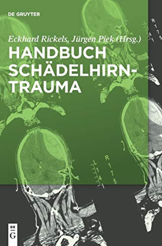 Handbuch Schädelhirntrauma