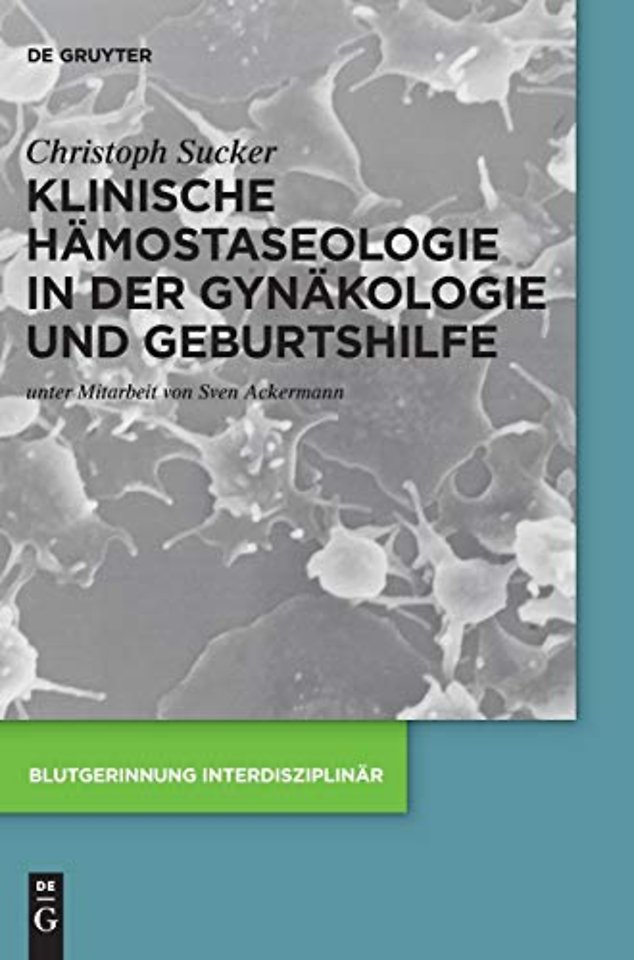 Klinische Hämostaseologie in der Gynäkologie und Geburtshilfe