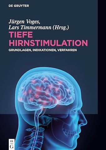 Tiefe Hirnstimulation – Grundlagen, Indikationen, Verfahren