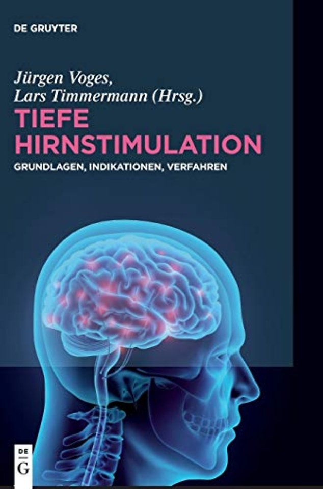Tiefe Hirnstimulation – Grundlagen, Indikationen, Verfahren