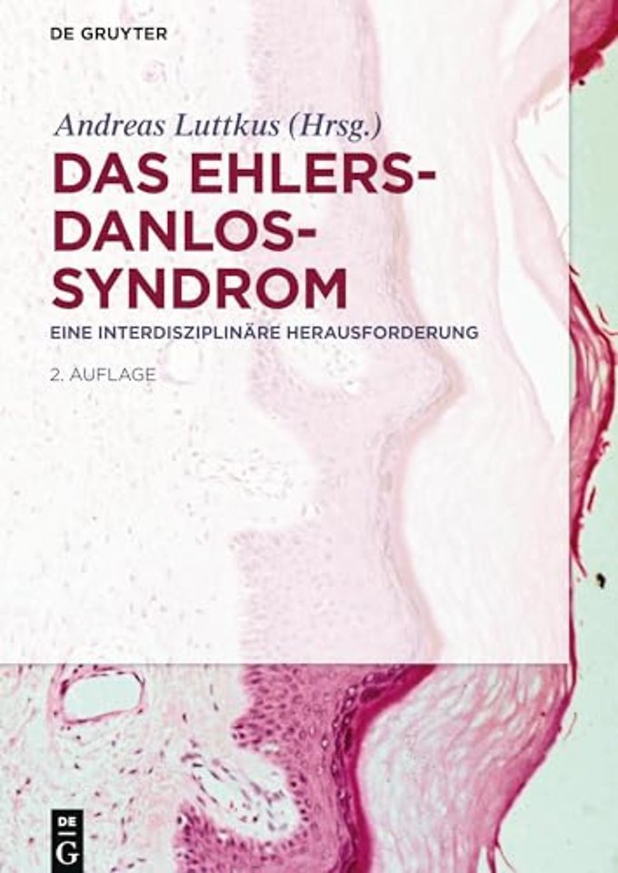 Das Ehlers–Danlos–Syndrom – Eine interdisziplinäre Herausforderung