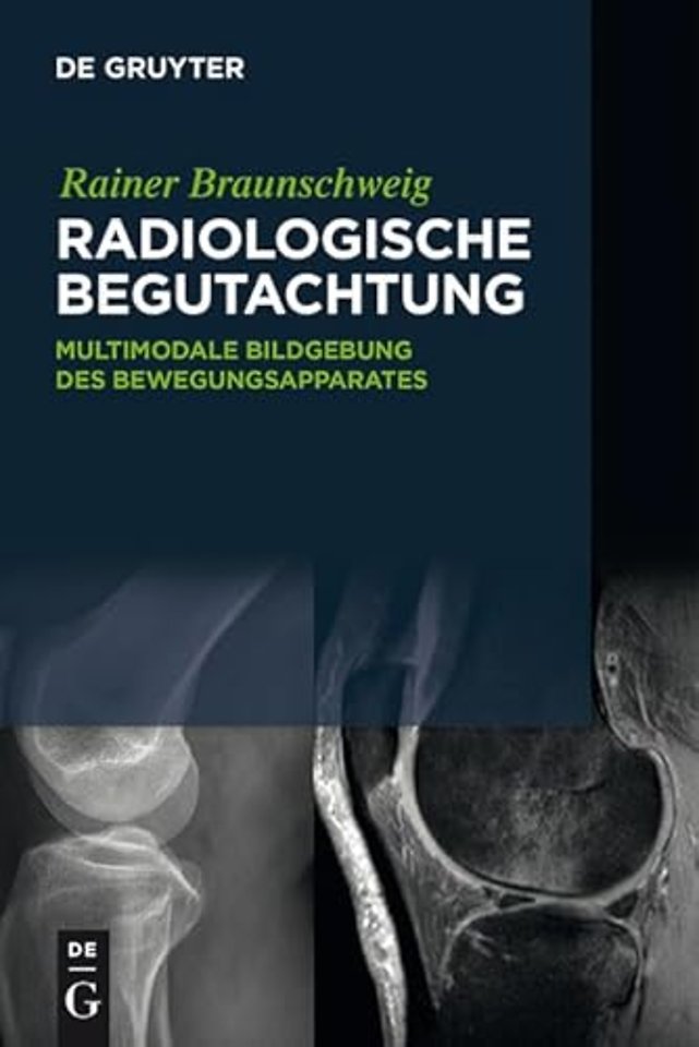 Radiologische Begutachtung – Multimodale Bildgebung des Bewegungsapparates