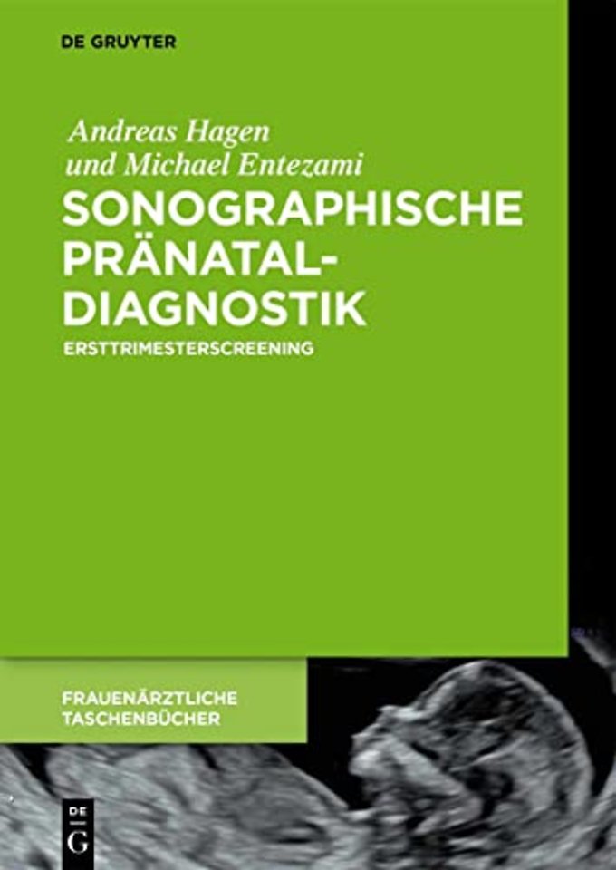 Sonographische Pränataldiagnostik – Ersttrimesterscreening