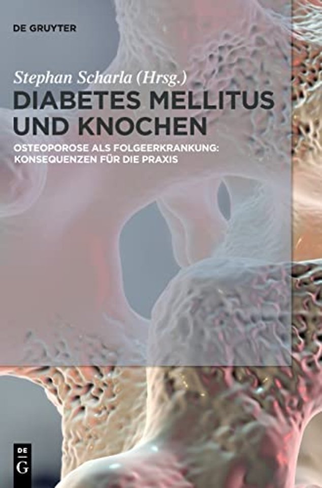 Diabetes Mellitus und Knochen – Osteoporose als Folgeerkrankung: Konsequenzen für die Praxis