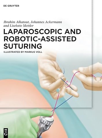 Laparoscopic and Robotic–Assisted Suturing