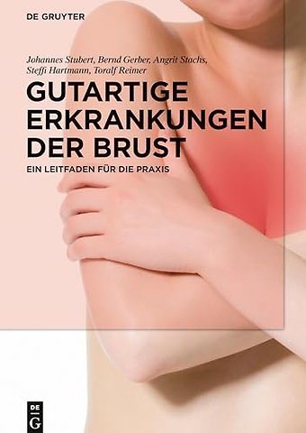 Gutartige Erkrankungen der Brust – Ein Leitfaden für die Praxis
