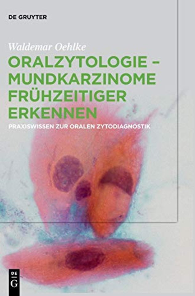 Oralzytologie – Mundkarzinome frühzeitiger erken – Praxiswissen zur Oralen Zytodiagnostik