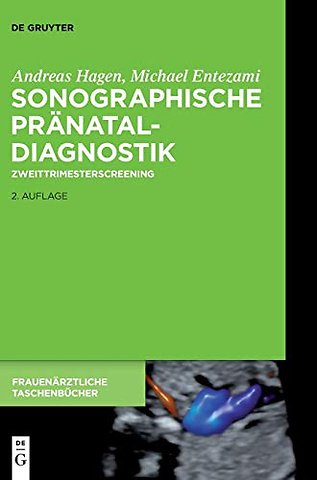 Sonographische Pränataldiagnostik – Zweittrimesterscreening