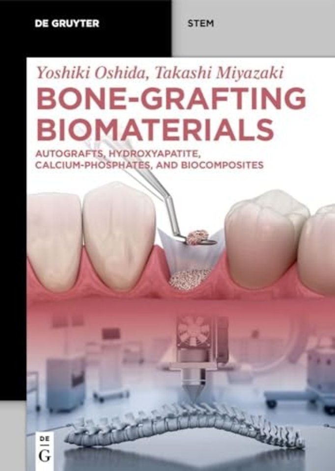 Bone–Grafting Biomaterials – Autografts, Hydroxyapatite, Calcium–Phosphates, and Biocomposites
