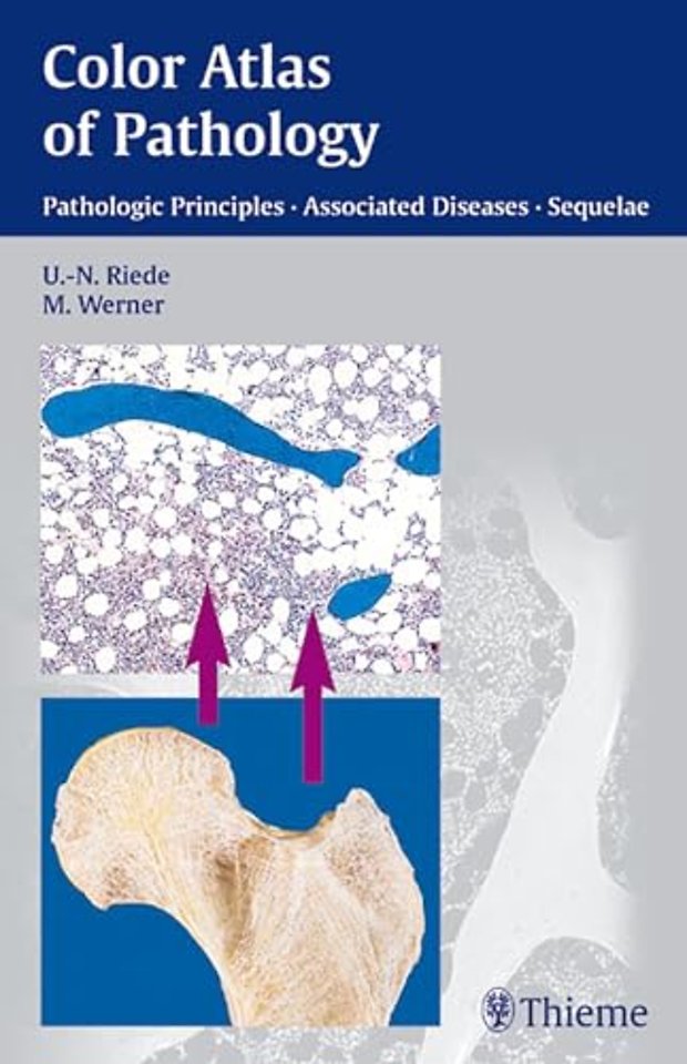 Color Atlas of Pathology – Pathologic Principles, Associated Diseases, Sequela
