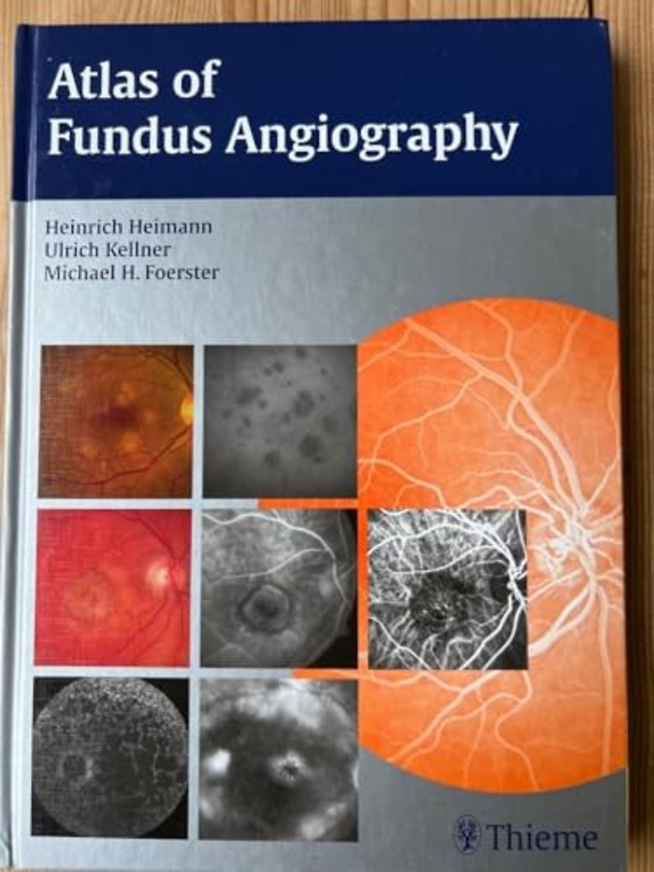 Atlas of Fundus Angiography