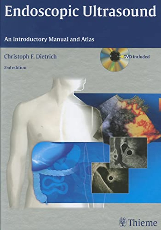 Endoscopic Ultrasound – An Introductory Manual and Atlas