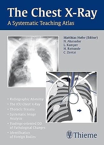 The Chest X–Ray – A Systematic Teaching Atlas