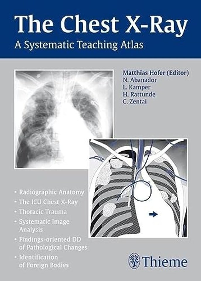 The Chest X–Ray – A Systematic Teaching Atlas