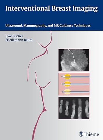Interventional Breast Imaging – Ultrasound, Mammography, and MR Guidance Techniques