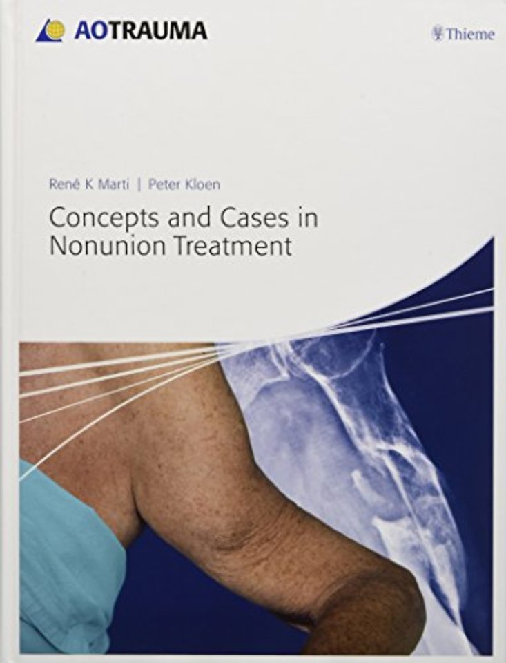 Concepts and Cases in Nonunion Treatment