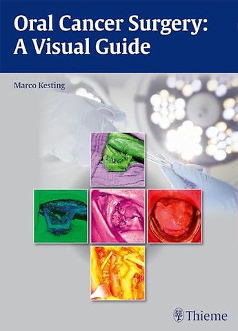 Oral Cancer Surgery – A Visual Guide