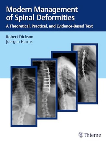 Modern Management of Spinal Deformities – A Theoretical, Practical, and Evidence–Based Text