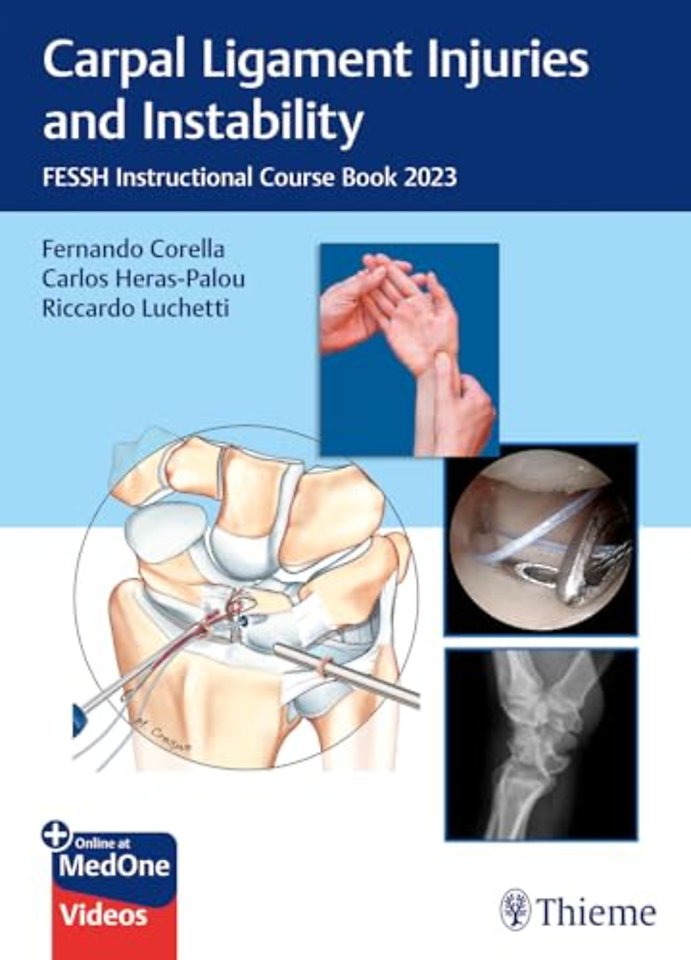 Carpal Ligament Injuries and Instability – FESSH Instructional Course Book 2023