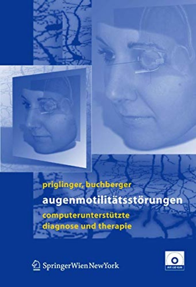 Augenmotilitätsstörungen