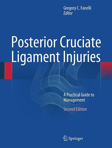 Posterior Cruciate Ligament Injuries
