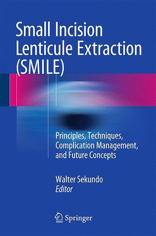 Small Incision Lenticule Extraction (SMILE)