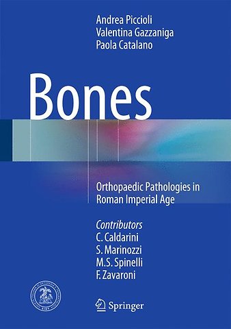 Bones